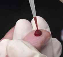 Analýza krevních pinworms (enterobiózy)