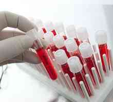 Krevní testy pro opistorhoz (IFA, biochemie), protilátky (atm)