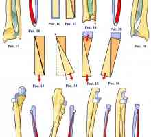 Anatomická struktura poloměru a ulna jednotky