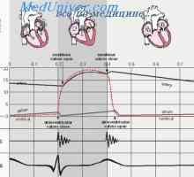 Srdeční ozvy. Příčiny první a druhé srdeční ozvy