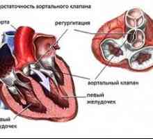 Aorty onemocnění srdce: léčba, příznaky, znaky, příčiny