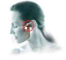 Artritida temporomandibulárního kloubu: léčba, příznaky, diagnóza
