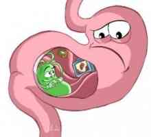 Atrofická gastritis: léčba, příznaky, znaky, příčiny
