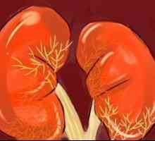 Autozomálně dominantní polycystické onemocnění ledvin