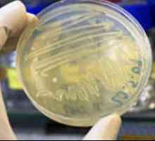 Biochemická analýza fekální bakterie přerůstání