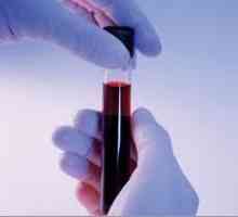 Biochemická analýza krve pro pankreatitidy