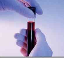 Biochemická analýza krve