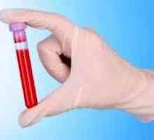 Krev biochemie pankreatu s pankreatitidou