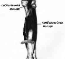 Bolest zad způsobená musculus soleus