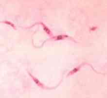 Chagasova choroba: symptomy, léčba, příčiny, diagnostika, příčiny
