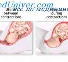 Břišních svalů během porodu. děložní činnost