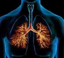 Bronchiektázie v plicích: léčba, příznaky, diagnostika, příčiny, příznaky