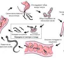 Časté infekce (červ zamoření) roupy (enterobiózy) man