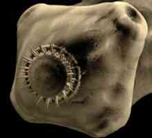 Červ parazit vepřové tasemnice, Taeniasis lidské nemoci