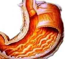 Co je atrofická gastroduodenitis?