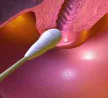 Cytologické vyšetření děložního hrdla