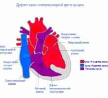 Defekt komorového septa srdce: na příčiny, léčba, příznaky, znaky