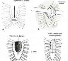 Deformace hrudníku. defekty hrudní kosti