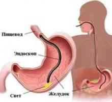 Diagnóza gastroduodenita