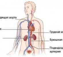 Disekce aorty: klasifikace, příčiny, příznaky, léčba, co se děje?