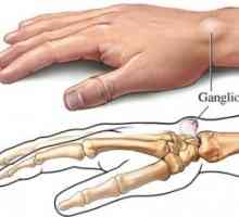 Benigní nádory měkkých tkání ruky: léčba, příčiny, příznaky, znaky