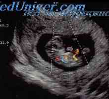Doppler ultrazvuk plodu. Proud Studie krve do fetálního ductus venosus