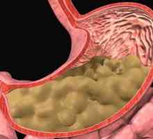 Fibrinózní gastritidu