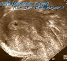 Funkční změna působením ultrazvuku. Fetální anomálie pod Uzi