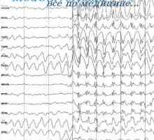 Co způsobuje a zastaví velký epileptický záchvat? Malaya epilepsie