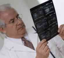 Gynekomastie u mužů léčených, symptomy, příčiny, příznaky