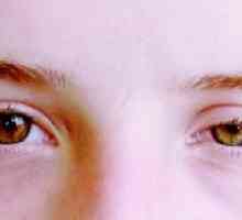 Oční ischemický syndrom: symptomy, léčba, klasifikace, příčiny