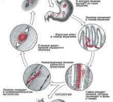 Helminti (červi), které žijí v lidských svalů, příznaků a fotky
