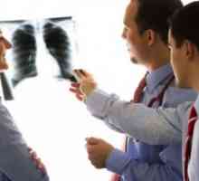 Chronická intersticiální pneumonie a plicní fibrózy, léčba, příznaky, příčiny