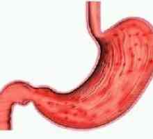Chronický zánět žaludku s ohniskovou slizniční atrofie symptomech, léčbě a stravě