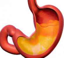 Chronický zánět žaludku s sekreční funkci