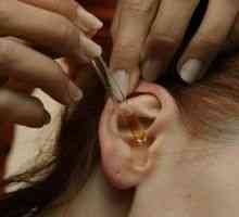 Chronický hnisavý zánět středního ucha: léčba, příznaky, znaky, příčiny