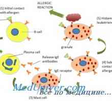 Imunoglobulinu E (IgE) a eosinofilů v alergických reakcí