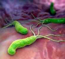 Infekce Helicobacter pylori: léčba, příznaky, příčiny, diagnostika, symptomy