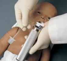 Neonatální intubace: Pipe Technology intubace