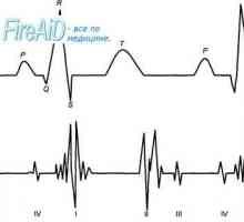 Srdeční ozvy. První (systolický) srdeční zvuk. Druhá (diastolický) srdeční zvuk. Phonocardiogram.
