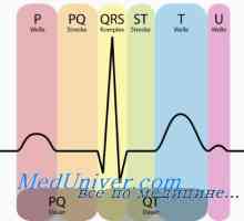 Tři standardní svody EKG. Hrudník svodový elektrokardiogram