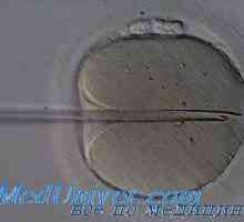 Oplodnění in vitro (IVF). Příležitosti a vyhlídky