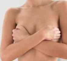 Ekzém na bradavky prsu: Prostředky pro léčbu, symptomy, příčiny
