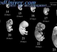 Embryologie v lékařské vzdělání. Problémy embryologie výuka
