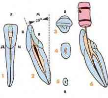 Endodontické aspekty morfologie dolních stálých zubů