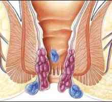 Ezofagitida a gastropatie erytematózní