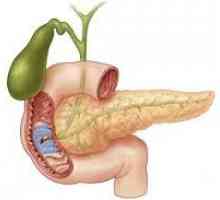 Erozivní a ulcerózní duodenitis