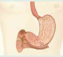 Jak se zhoršuje gastroduodenitis?