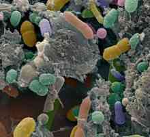 Jaké testy projít na dysbacteriosis?