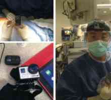 GoPro kamera trénovat chirurgy